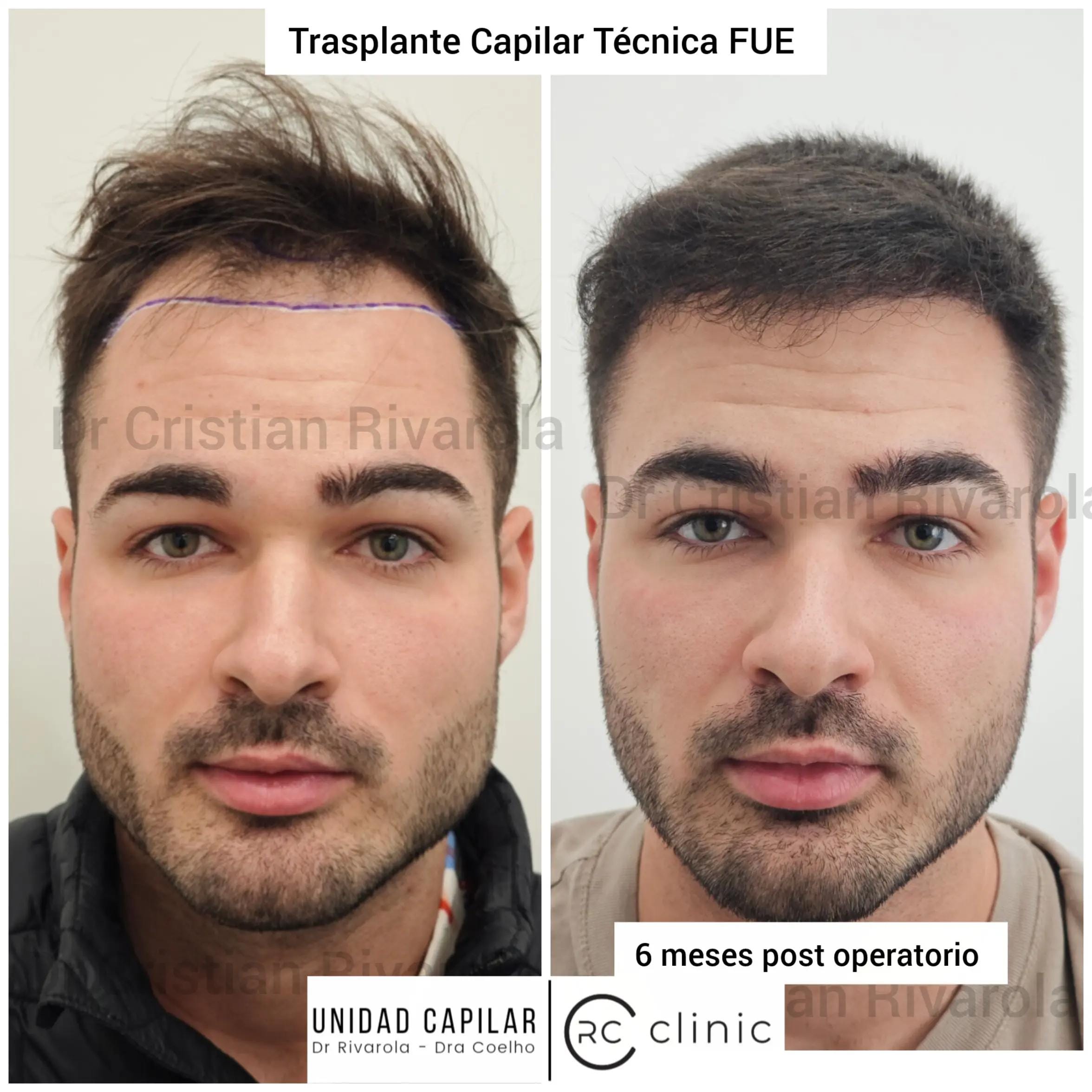 Post 5 by Dr Cristian Rivarola on TikTok (video)