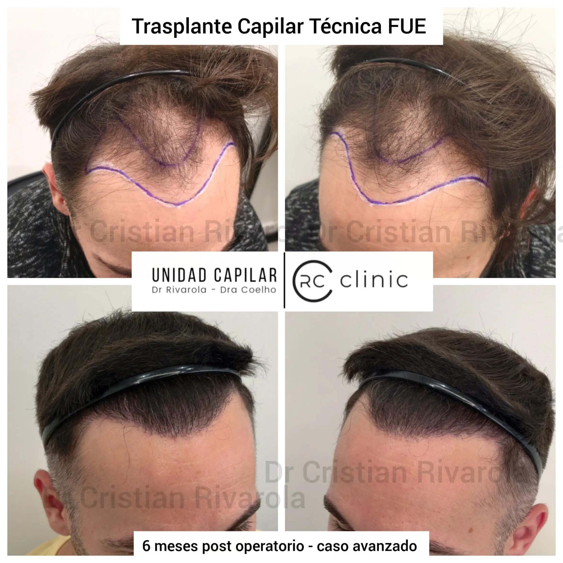 Post 3 by Dr Cristian Rivarola on TikTok (video)