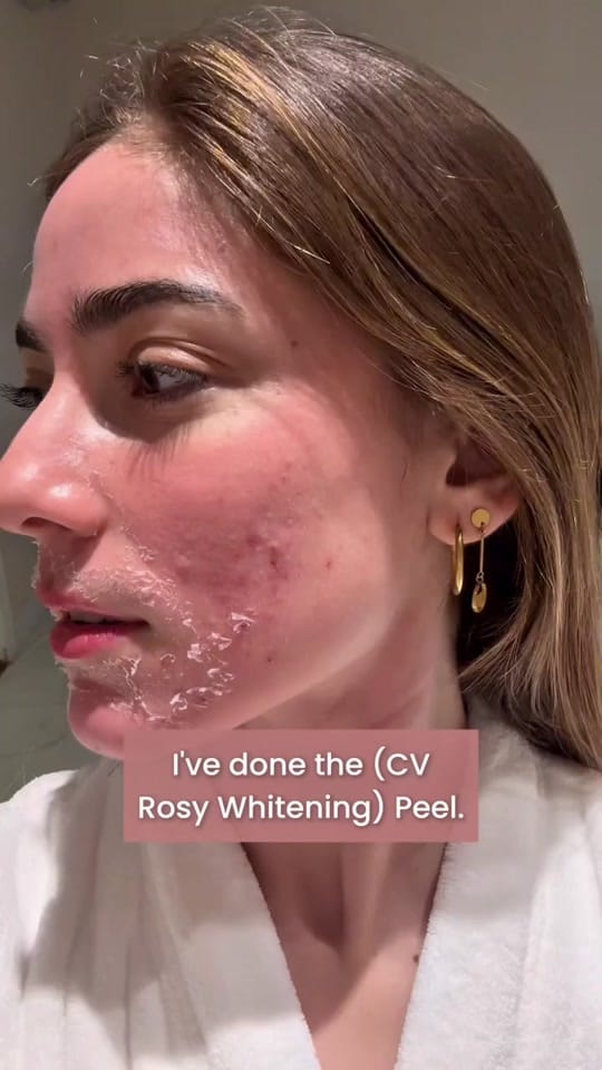 Post 8 by Cathy Valencia Skin Clinic on TikTok (video)
