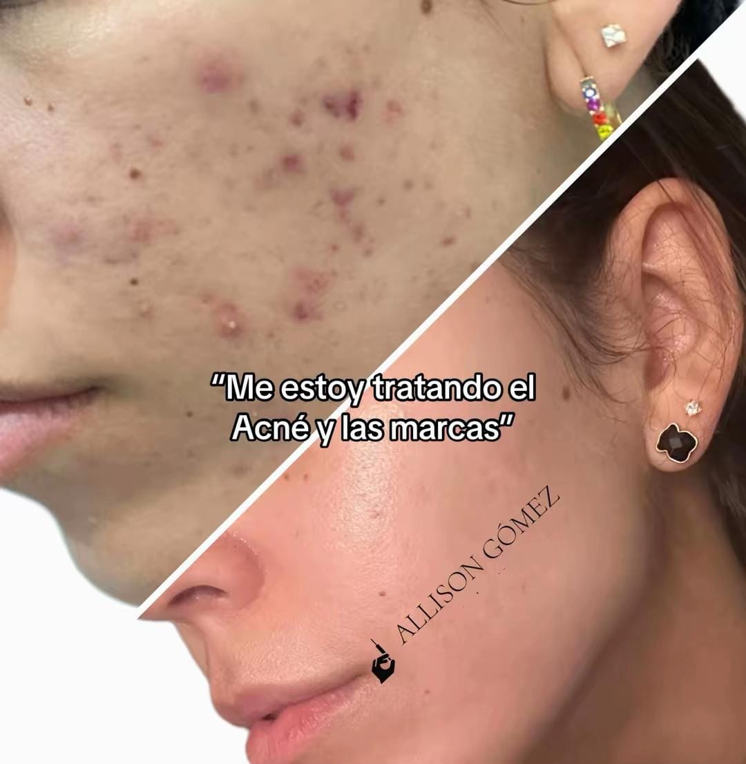Post 9 by allisonaesthetic on TikTok (video)