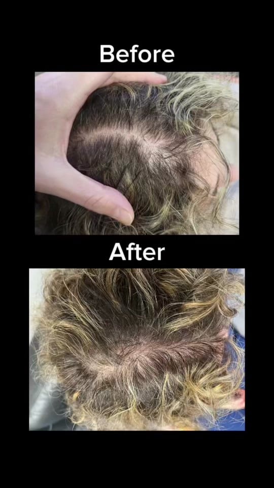 Post 4 by Rupal Mathur, MD, DABOM, CISSN on TikTok (video)