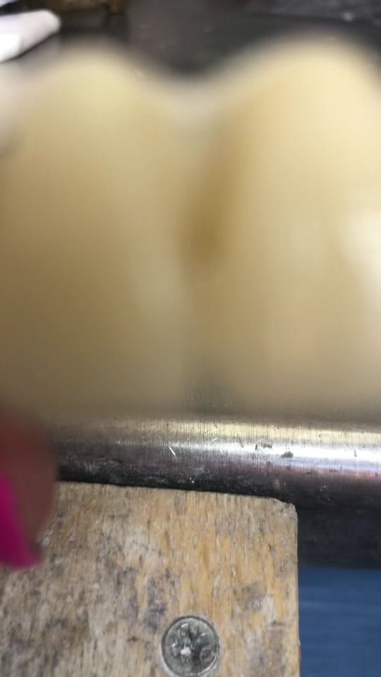 Post 5 by Laboratorio Dentalab3D on TikTok (video)