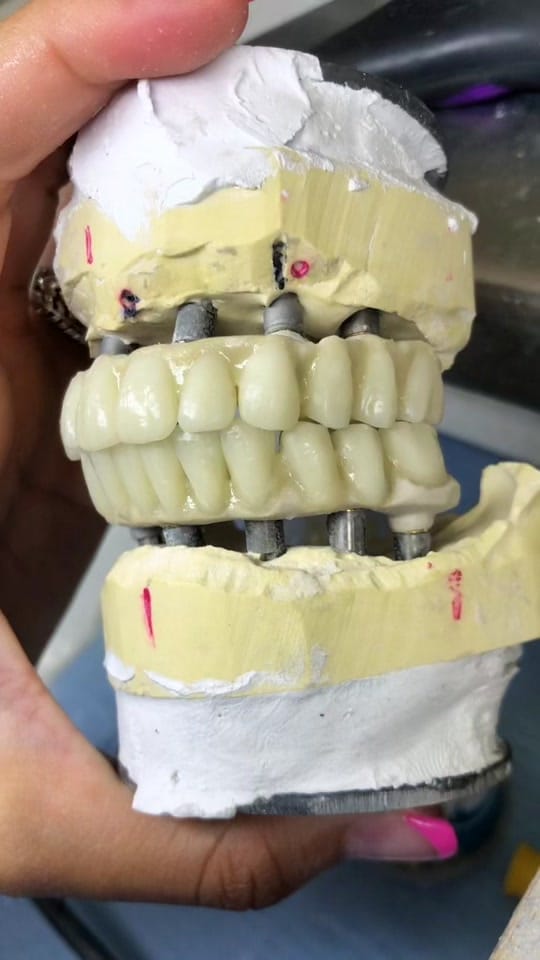 Post 4 by Laboratorio Dentalab3D on TikTok (video)