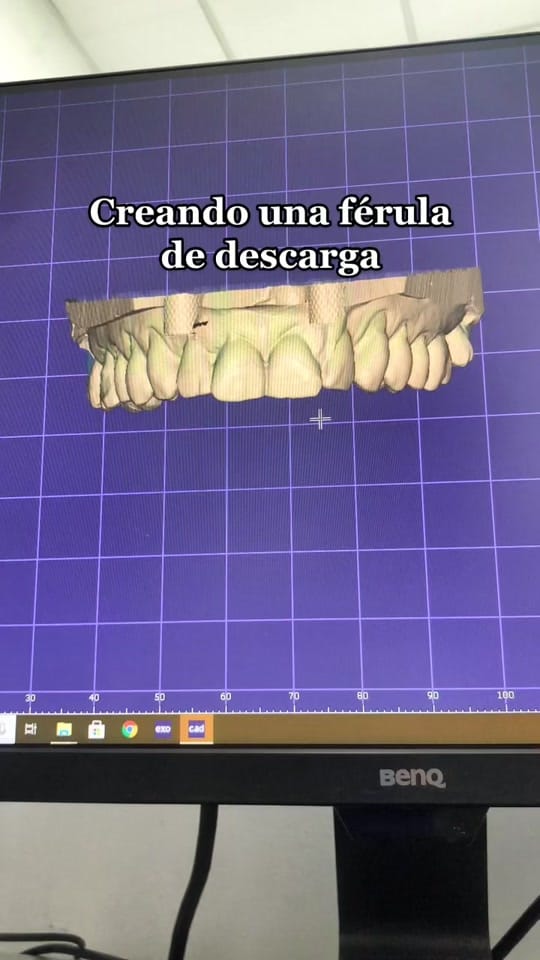 Post 10 by Laboratorio Dentalab3D on TikTok (video)