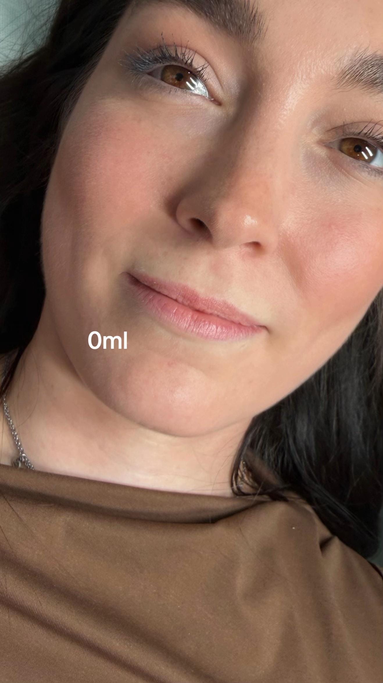 Post 5 by dranabellaglez on TikTok (video)