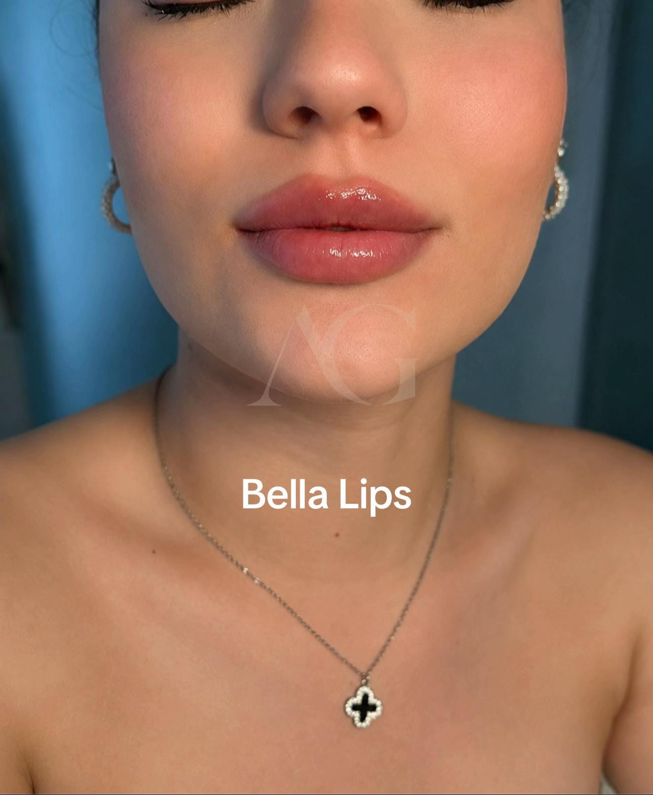 Post 6 by dranabellaglez on TikTok (video)