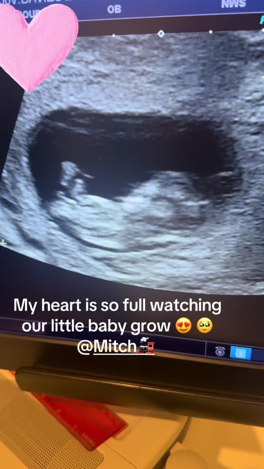 Post 1 by ℤ𝕠𝕖ℂ𝕙𝕒𝕣𝕝𝕠𝕥𝕥𝕖🦋🤍 on TikTok (video)
