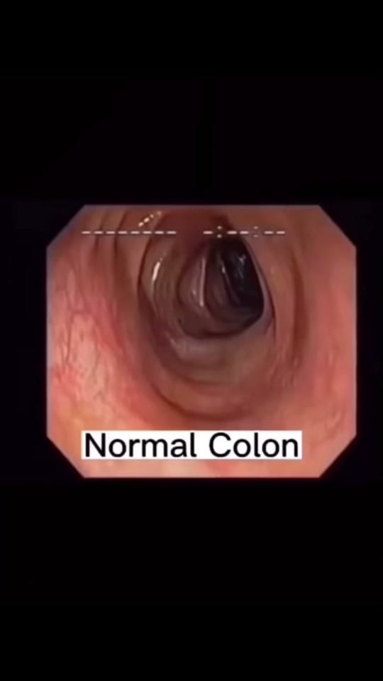 Post 8 by Tracy Ingram on TikTok (video)
