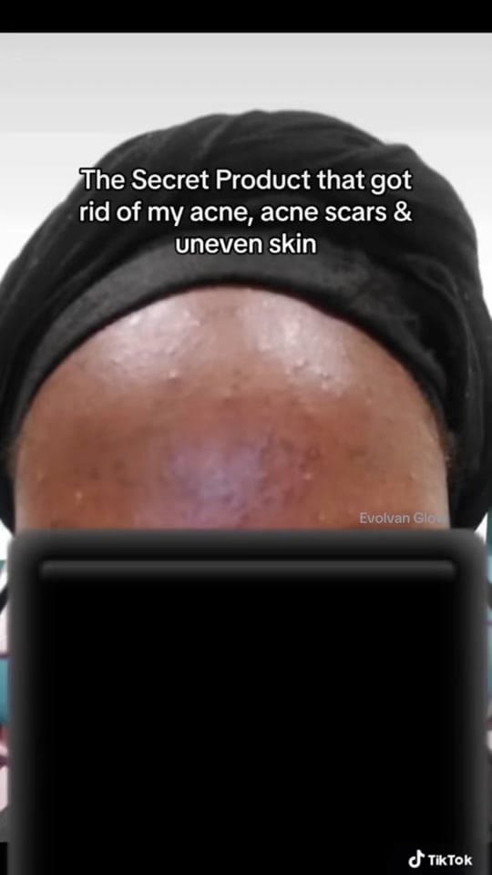 Post 2 by Glow | Skincare & Beauty ✨ on TikTok (video)