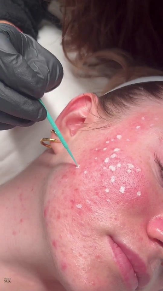 Post 8 by Adam and Eve Laser and Beauty on TikTok (video)