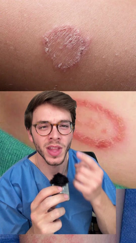 Post 10 by Dr. Vizcaíno Derma on TikTok (video)