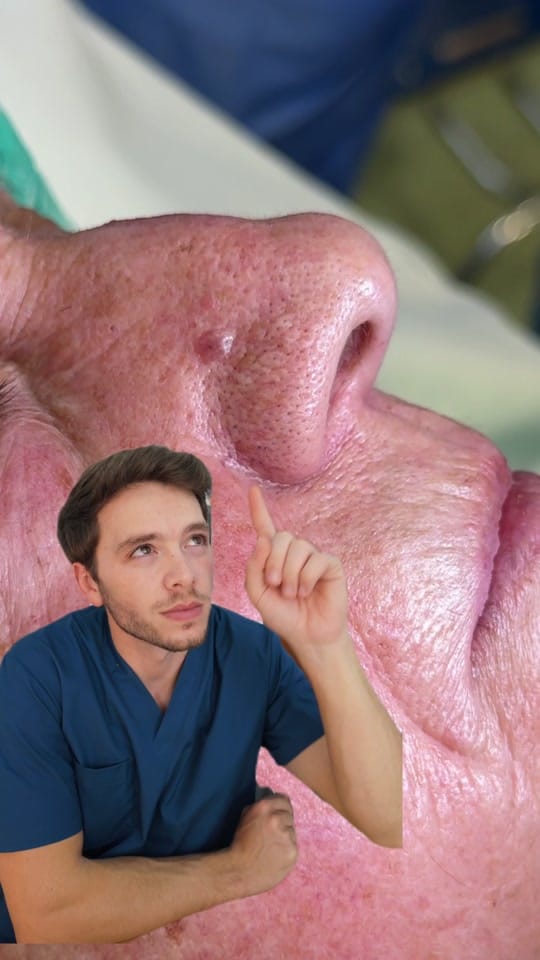 Post 2 by Dr. Vizcaíno Derma on TikTok (video)
