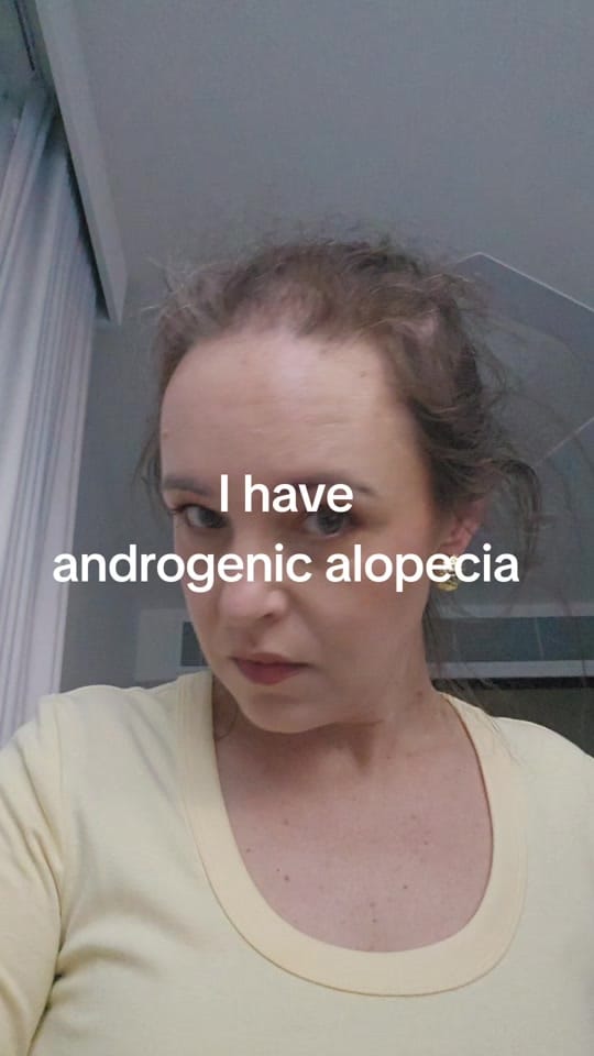Post 1 by Real_hair_barely_there🇦🇺💜 on TikTok (video)
