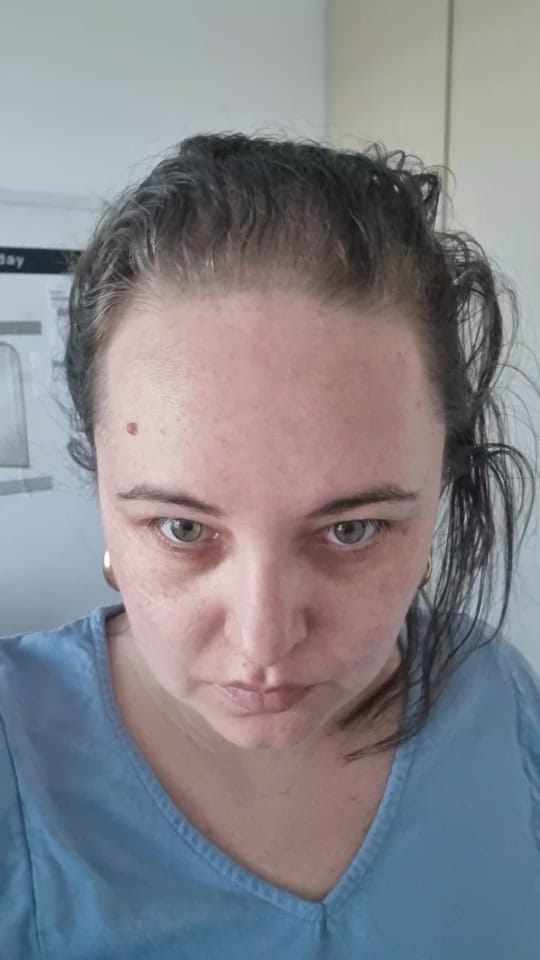 Post 10 by Real_hair_barely_there🇦🇺💜 on TikTok (video)
