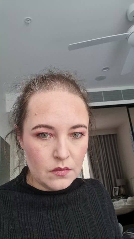 Post 8 by Real_hair_barely_there🇦🇺💜 on TikTok (video)