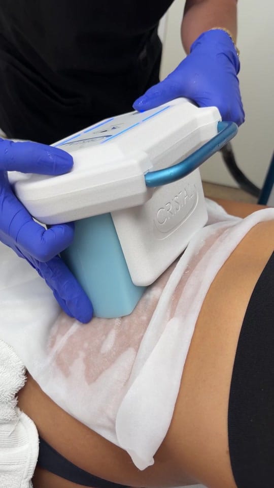 Post 2 by BODY SCULPTING CLINICS™ on TikTok (video)