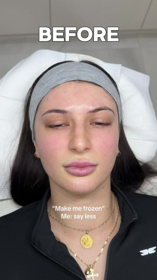 Post 4 by RN SABRINA | COSMETIC NURSE on TikTok (video)