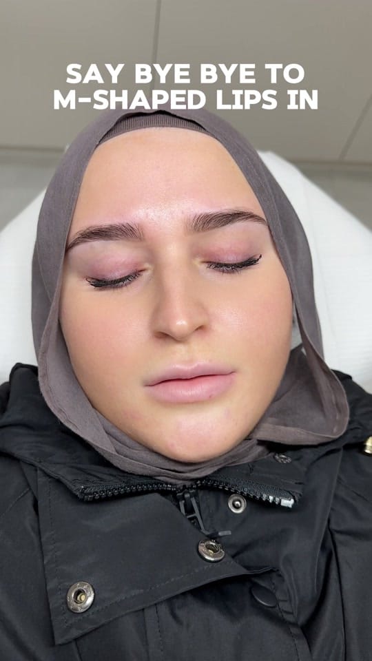 Post 9 by RN SABRINA | COSMETIC NURSE on TikTok (video)