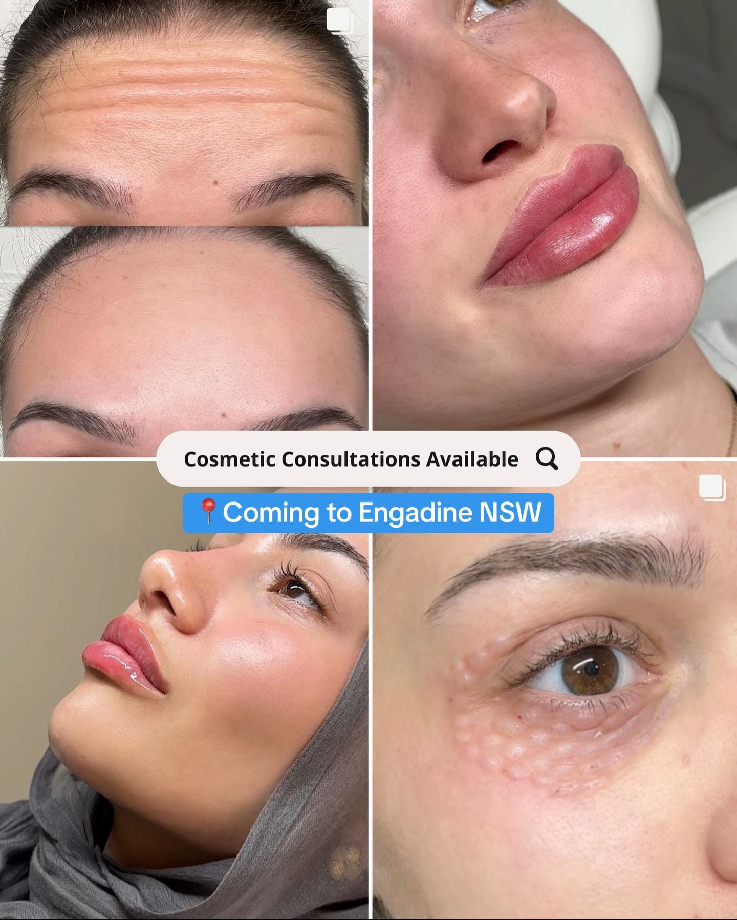 Post 2 by RN SABRINA | COSMETIC NURSE on TikTok (video)