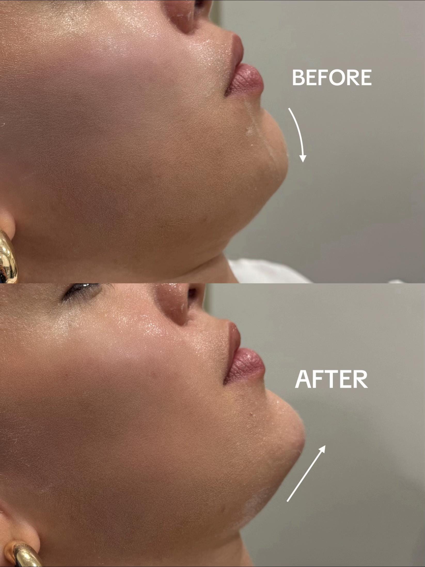 Post 8 by RN SABRINA | COSMETIC NURSE on TikTok (video)