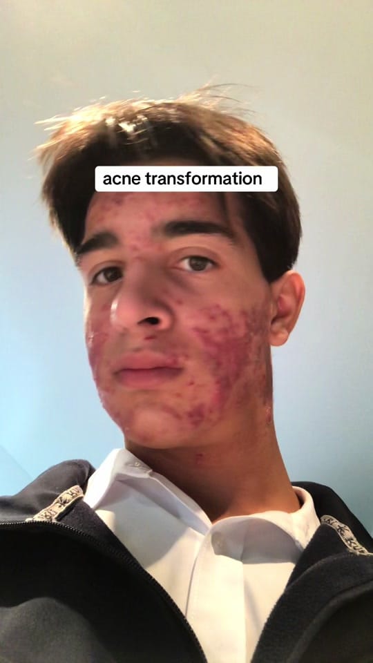 Post 2 by Luke Koumakis on TikTok (video)