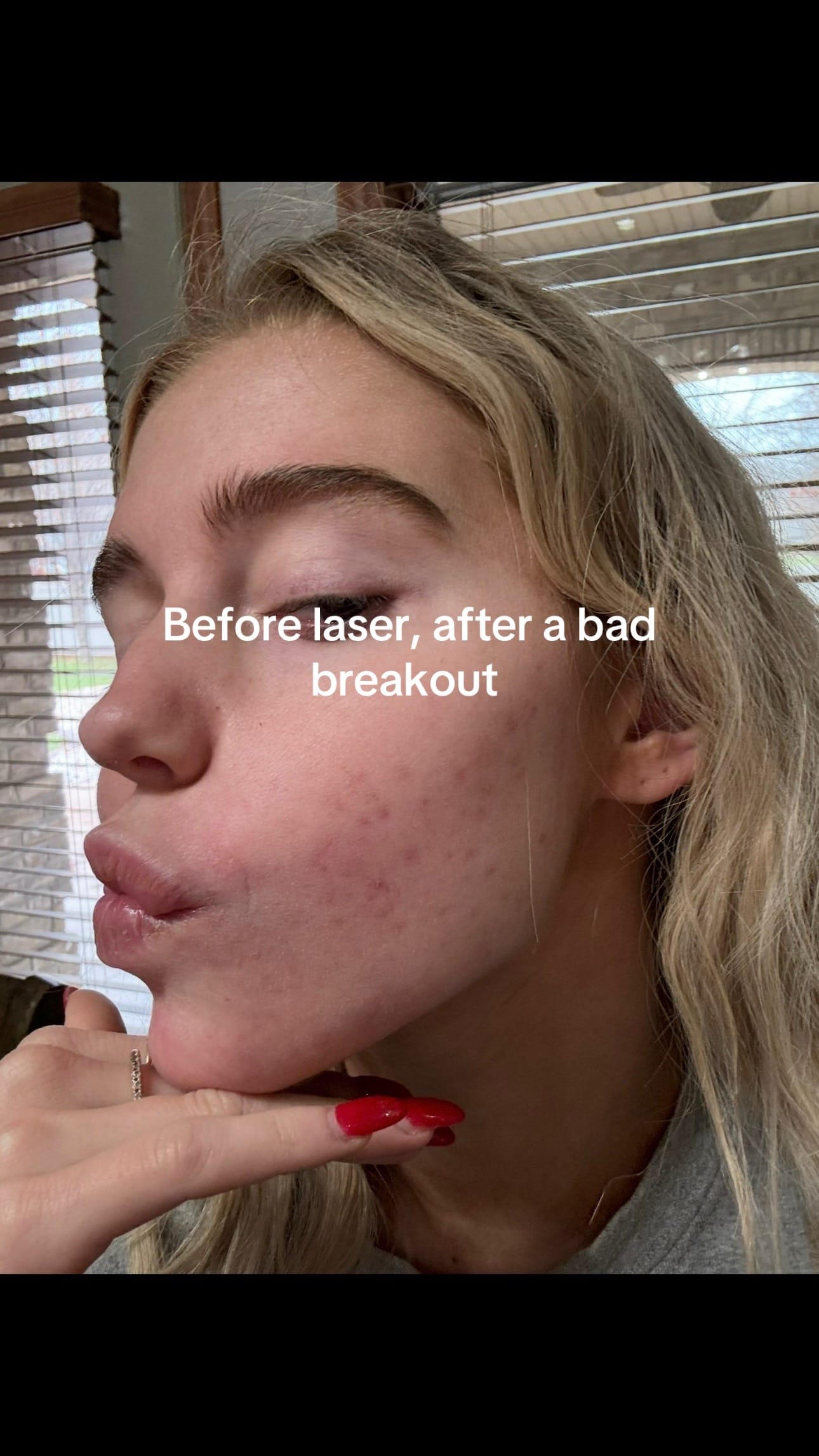Post 10 by Chanler Kate on TikTok (video)