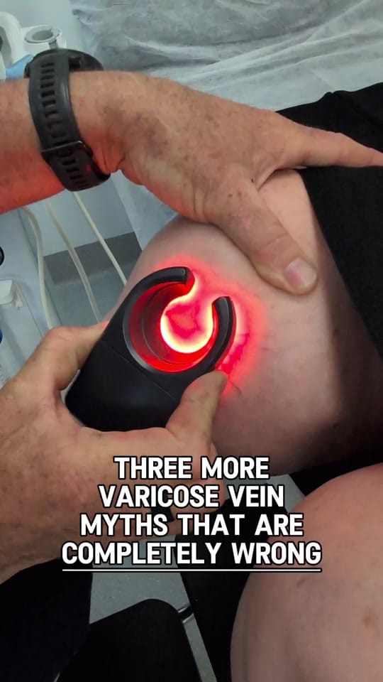 Post 2 by The Varicose Vein Clinic on TikTok (video)