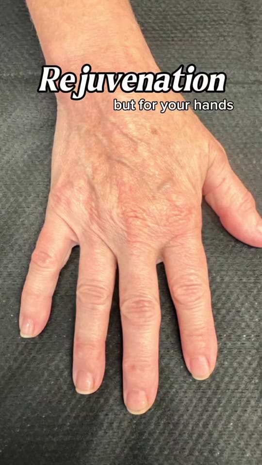 Post 5 by The Varicose Vein Clinic on TikTok (video)