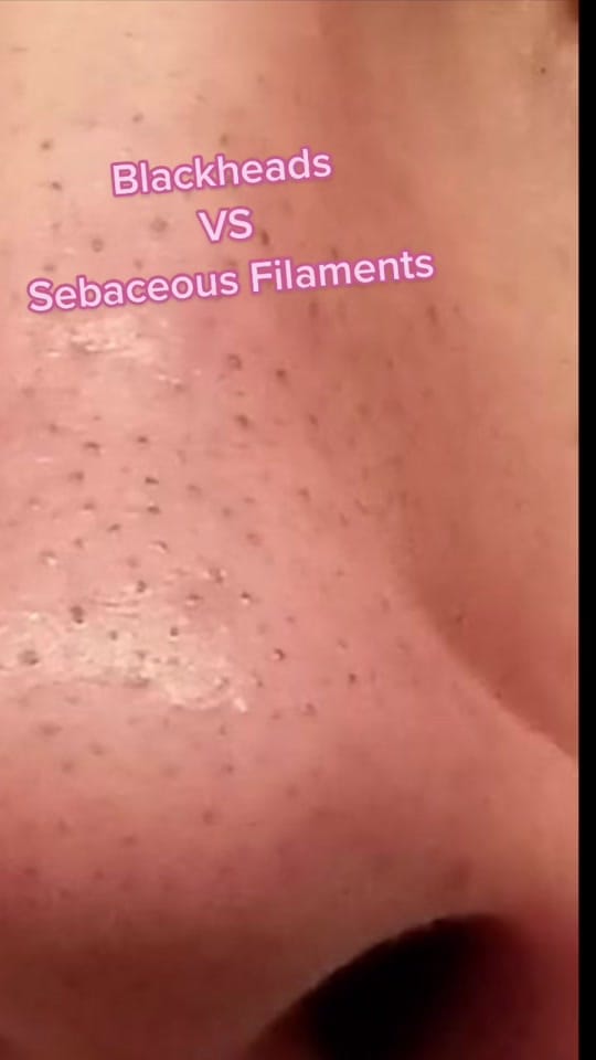 Post 10 by TEGANMAC.SKIN on TikTok (video)