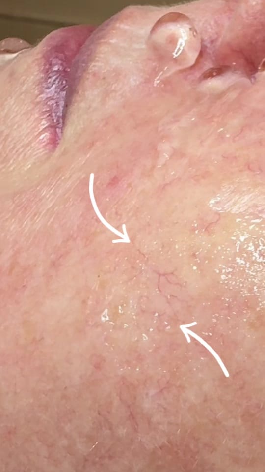 Post 4 by TEGANMAC.SKIN on TikTok (video)