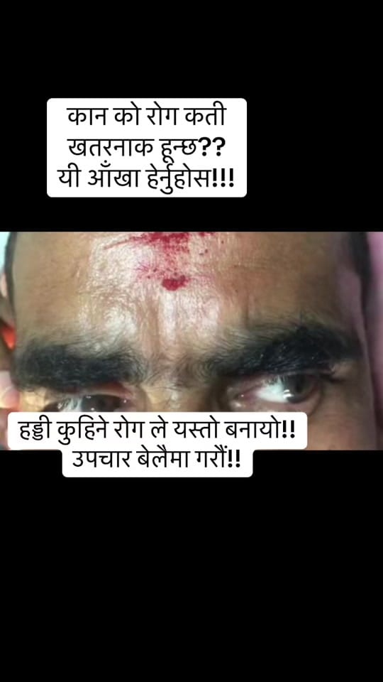 Post 10 by CharakENT Center Pokhara(nabin on TikTok (video)