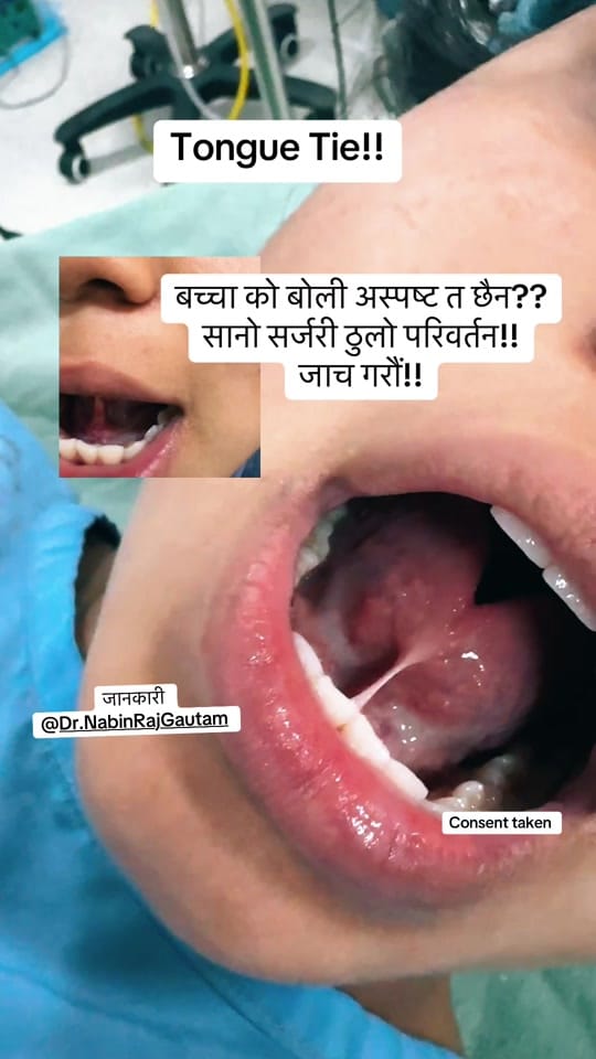 Post 1 by CharakENT Center Pokhara(nabin on TikTok (video)