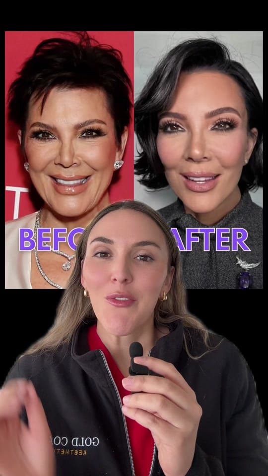 Post 8 by FNP Karina | OC Injector on TikTok (video)