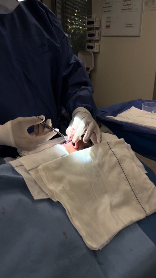 Post 6 by artisteplasticsurgery on TikTok (video)