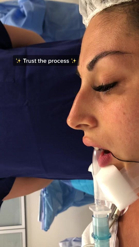 Post 4 by artisteplasticsurgery on TikTok (video)