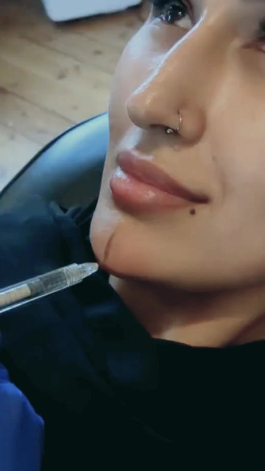 Post 1 by Cosmetique® (Cosmetic Clinics) on TikTok (video)