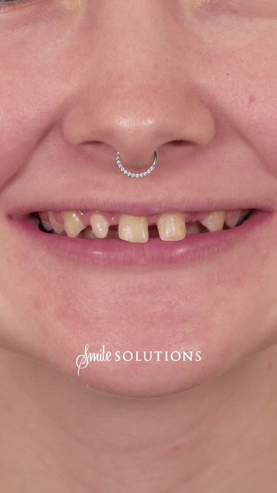 Post 2 by Smile Solutions on TikTok (video)