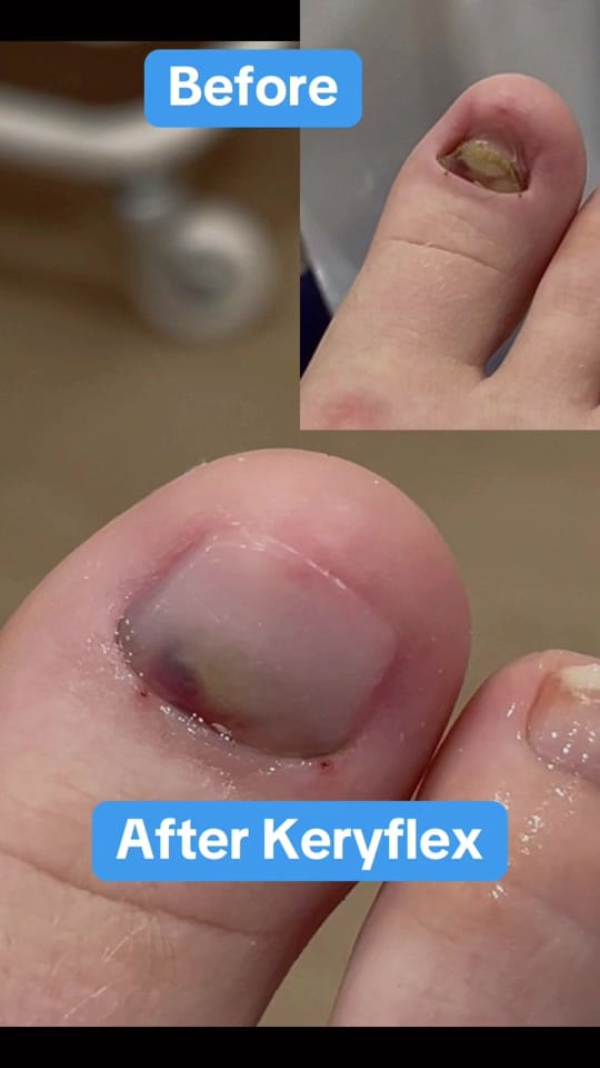Post 3 by Rose Bay Podiatry on TikTok (video)