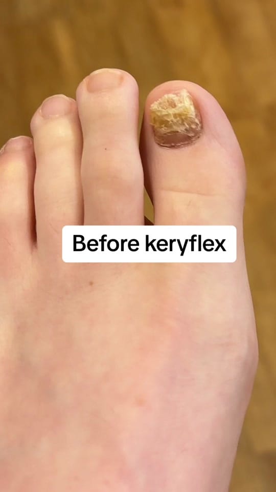 Post 9 by Rose Bay Podiatry on TikTok (video)