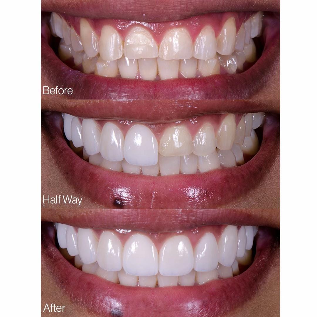 Post 7 by Vogue Dental Studios on TikTok (video)