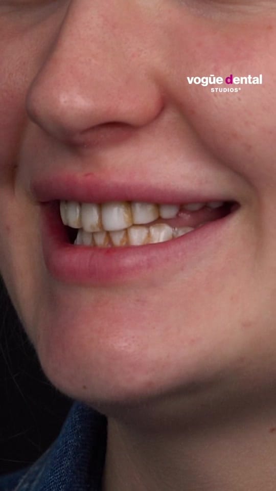 Post 3 by Vogue Dental Studios on TikTok (video)