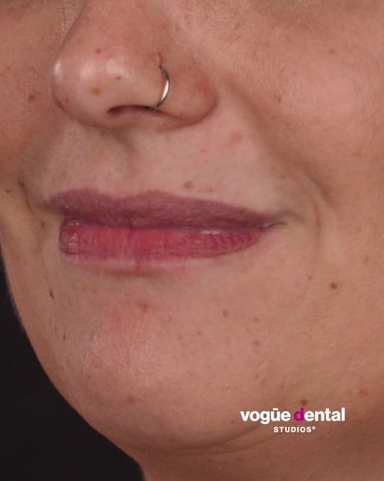Post 5 by Vogue Dental Studios on TikTok (video)
