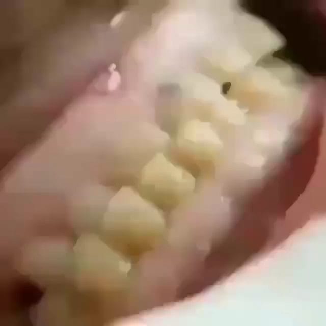 Post 5 by @tibb_telebesi1 on Instagram (video)