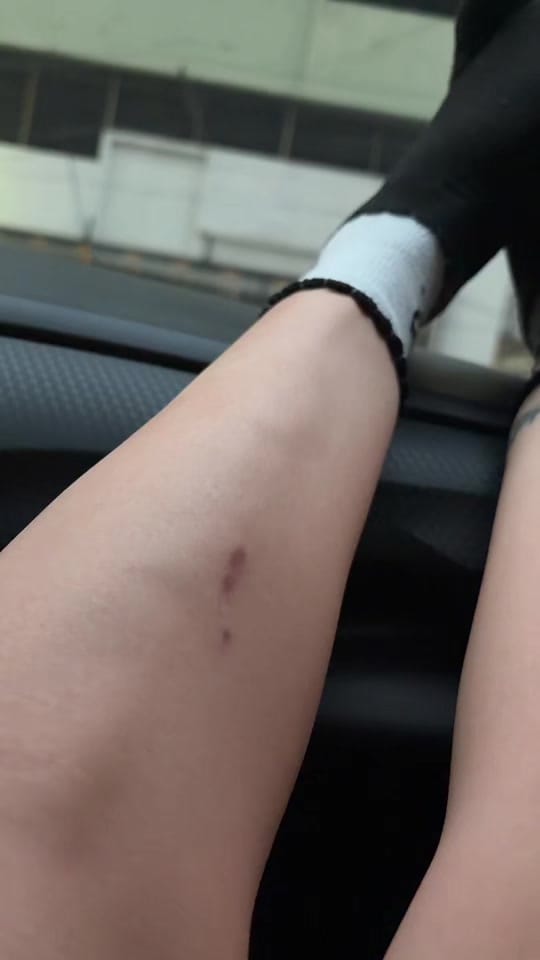 Post 8 by ASH 🐰 on TikTok (video)