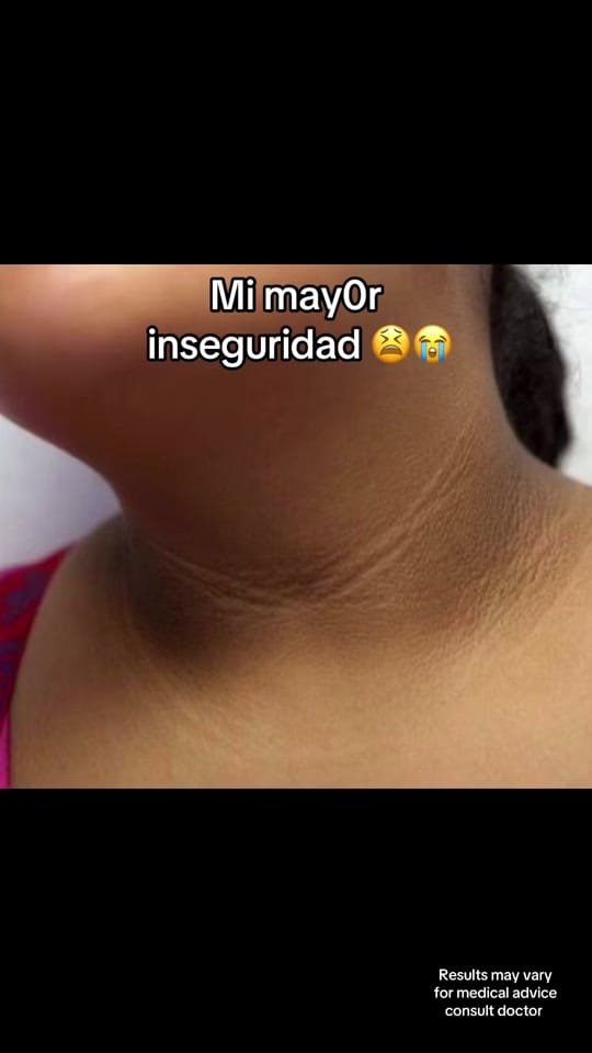Post 5 by Vgobeauty_h0621 on TikTok (video)