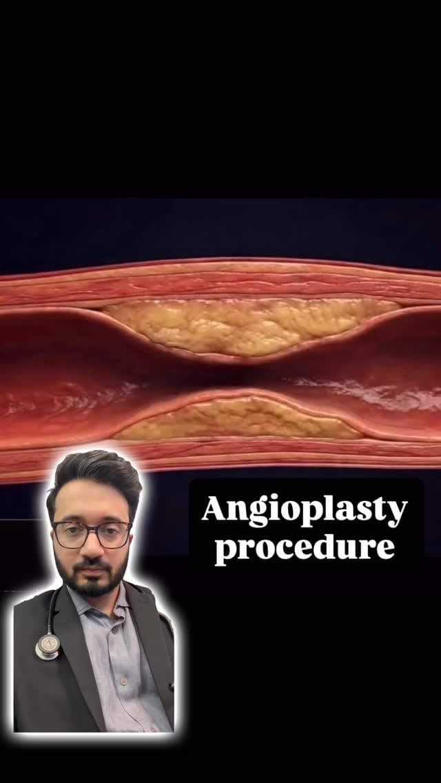 Post 7 by Dr. Tanmay S Kulkarni on Instagram (video)