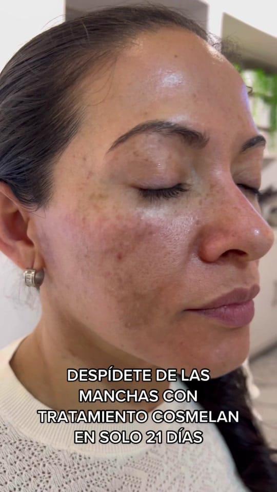 Post 10 by MARE SKINCARE EXPERT on TikTok (video)