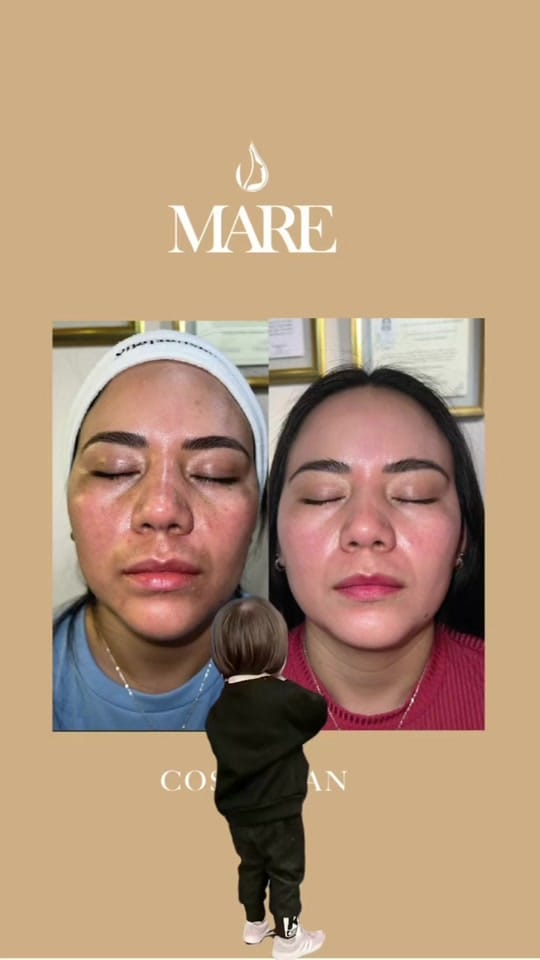 Post 1 by MARE SKINCARE EXPERT on TikTok (video)
