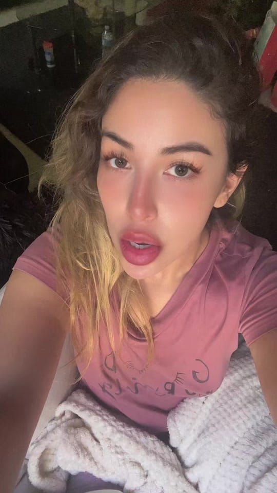 Post 8 by Dr.Beauty | Aesthetic Medicine on TikTok (video)