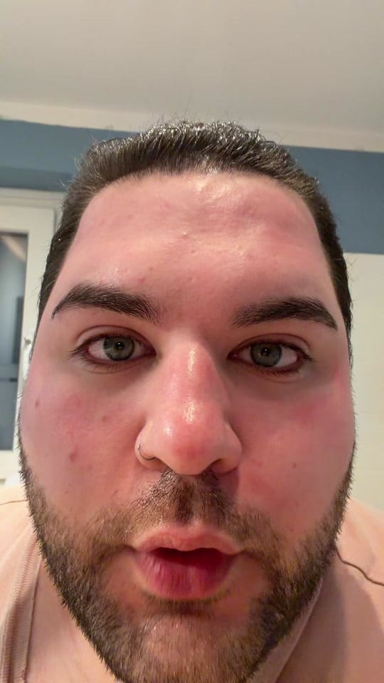Post 1 by maybexskincare on TikTok (video)